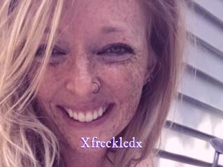 Xfreckledx